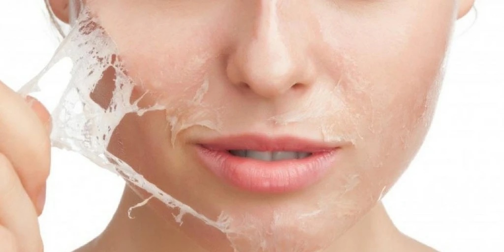 Smart Peeling Gel Solutions You Can trust On